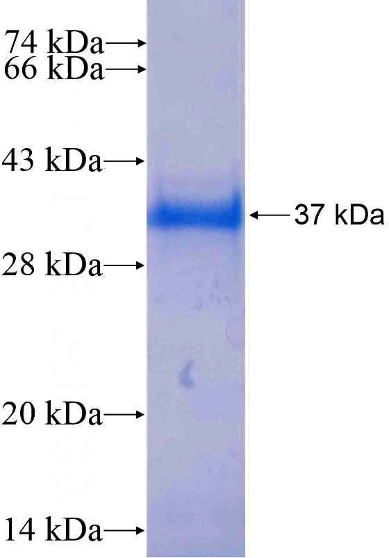 Recombinant Human ECHS1 SDS-PAGE