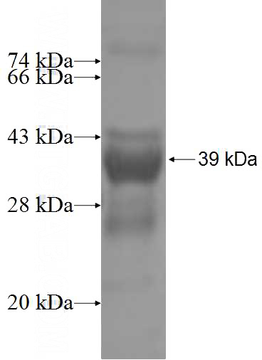 Recombinant Human CCNC SDS-PAGE