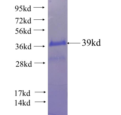 Recombinant human POLR2J SDS-PAGE