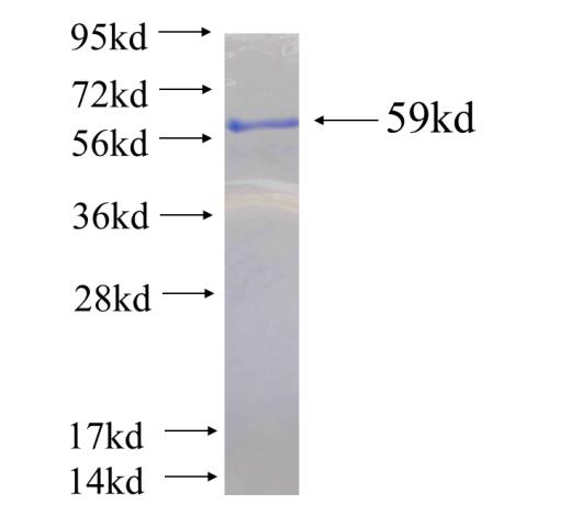 Recombinant human IFT88 SDS-PAGE