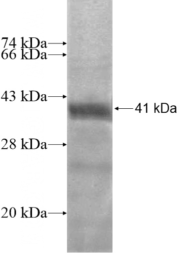 Recombinant Human ZNF559 SDS-PAGE
