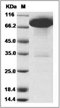 Rat DDR1 Kinase / MCK10 / CD167 Protein (Fc Tag) SDS-PAGE
