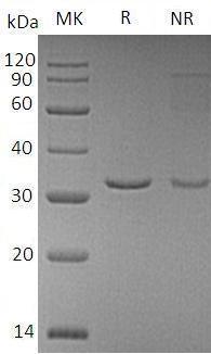 Human RIDA/HRSP12 (His tag) recombinant protein