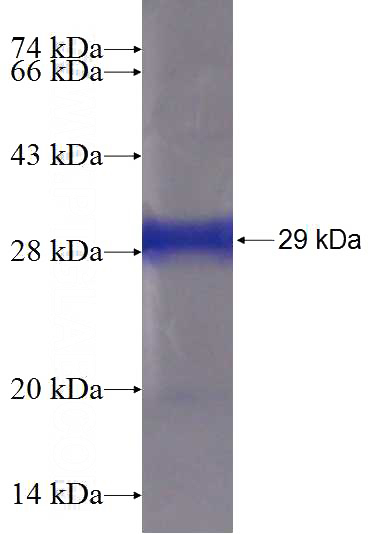 Recombinant Human PHLPPL SDS-PAGE