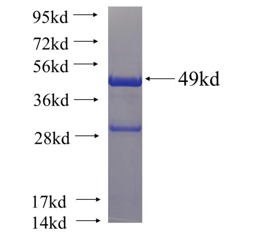 Recombinant human EHD4 SDS-PAGE