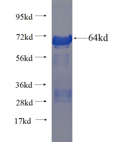 Recombinant human AEG-1 SDS-PAGE