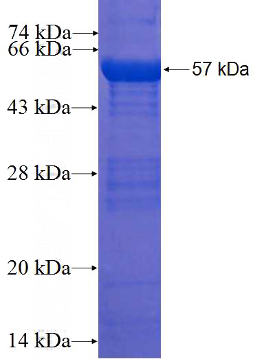 Recombinant Human C11orf74 SDS-PAGE