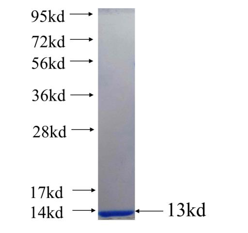 Recombinant human PIGV SDS-PAGE