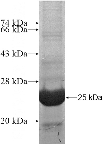 Recombinant Human AOC2 SDS-PAGE