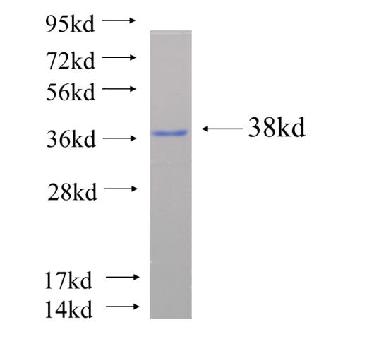 Recombinant human OLIG2(Full length) SDS-PAGE
