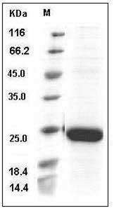 Cynomolgus IL-18 / IL-1F4 Protein (His Tag) SDS-PAGE