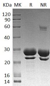 Human FKBP7/FKBP23/UNQ670/PRO1304 (His tag) recombinant protein