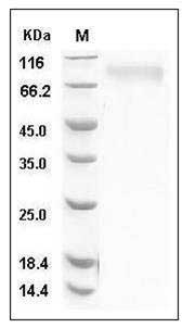 Human Thrombopoietin / THPO / TPO Protein (His Tag) SDS-PAGE
