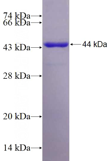 Recombinant Human MAP2K4 SDS-PAGE