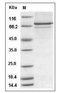 Human MAPKAPK5 Protein (His & GST Tag) SDS-PAGE
