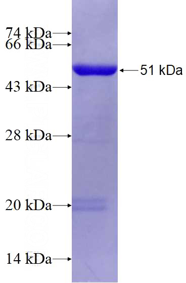 Recombinant Human PSMC5 SDS-PAGE