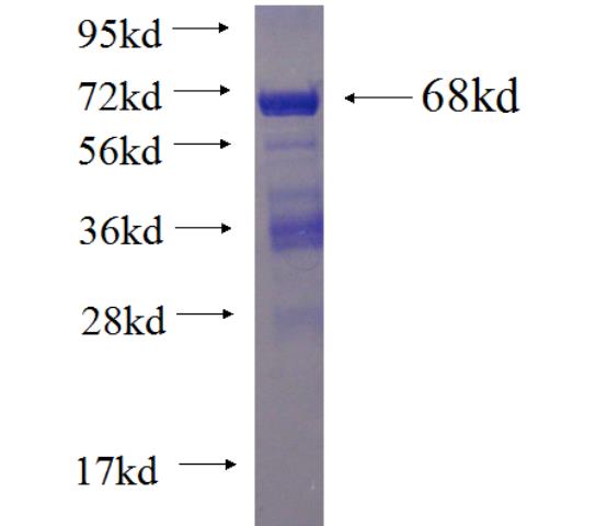 Recombinant human PALLD,palladin SDS-PAGE