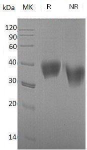 Mouse Cd33/Siglec3 (His tag) recombinant protein