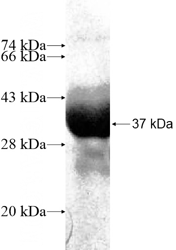 Recombinant Human LETM2 SDS-PAGE