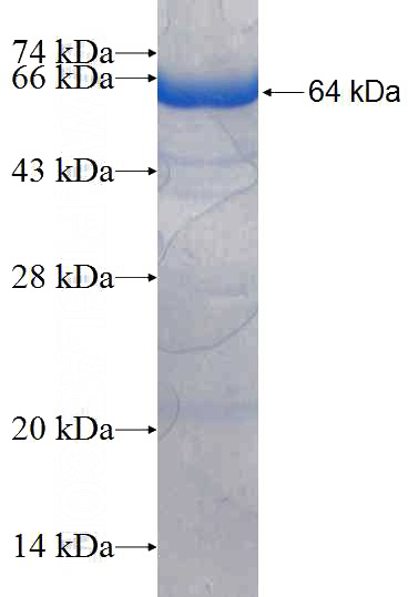 Recombinant Human MLYCD SDS-PAGE