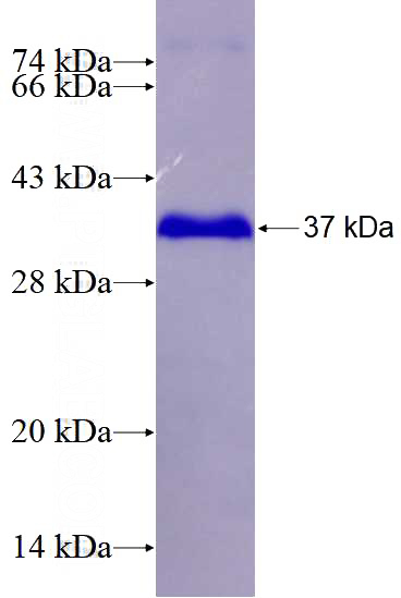 Recombinant Human ZBTB16 SDS-PAGE