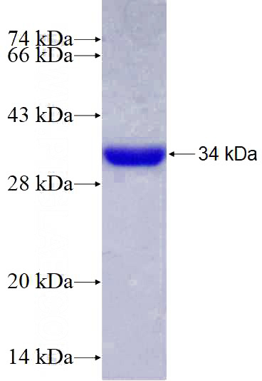 Recombinant Human GIMAP2 SDS-PAGE