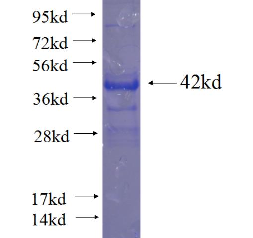 Recombinant human RTN4RL2 SDS-PAGE