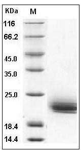 Human LAIR2 / CD306 Protein (His Tag) SDS-PAGE