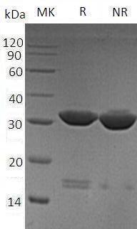 Human CA4 (His tag) recombinant protein