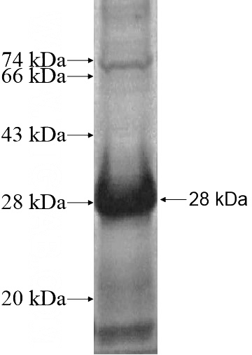 Recombinant Human SPRY3 SDS-PAGE