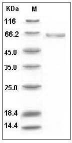 Human Alkaline Phosphatase / ALPL Protein (His Tag) SDS-PAGE