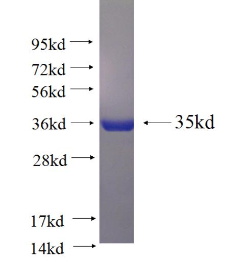 Recombinant human PGAM2 SDS-PAGE
