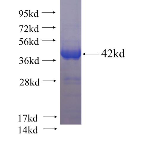 Recombinant human MYBPC3 SDS-PAGE