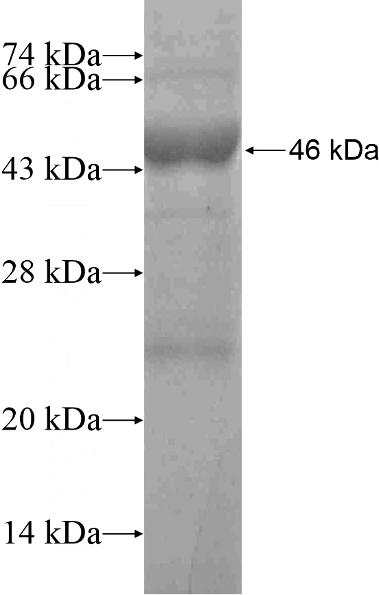 Recombinant Human HEATR6 SDS-PAGE