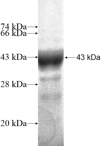 Recombinant Human TEX11 SDS-PAGE