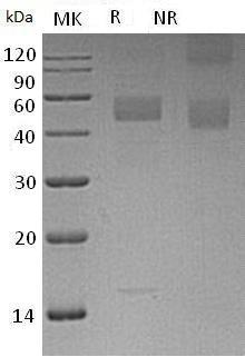 Human INHBC (His tag) recombinant protein
