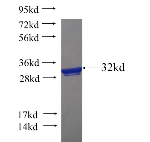 Recombinant human FBP2 SDS-PAGE
