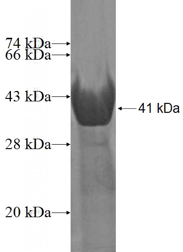 Recombinant Human NAB2 SDS-PAGE