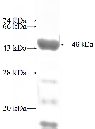 Recombinant Human TMOD2 SDS-PAGE