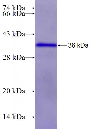 Recombinant Human ZNF124 SDS-PAGE