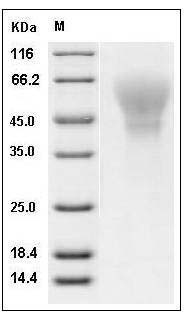 Human C4.4A / LYPD3 Protein (His Tag) SDS-PAGE
