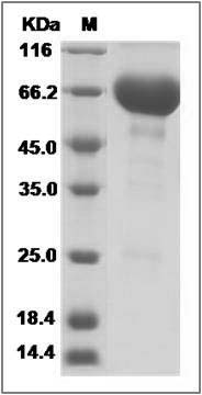 Human CD48 / SLAMF2 / BCM1 Protein (Fc Tag) SDS-PAGE
