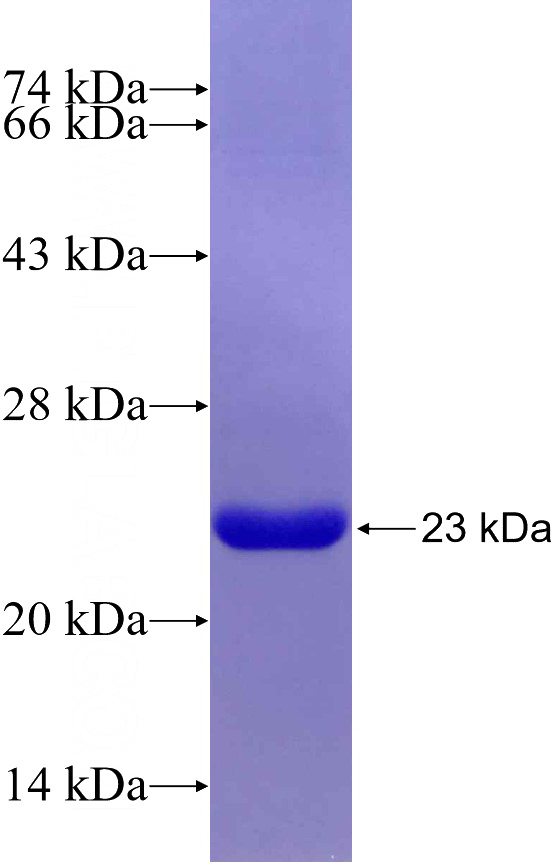 Recombinant Human KNL1 SDS-PAGE