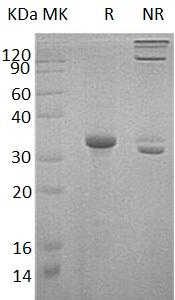 Human ENG/END (Trx & His tag) recombinant protein