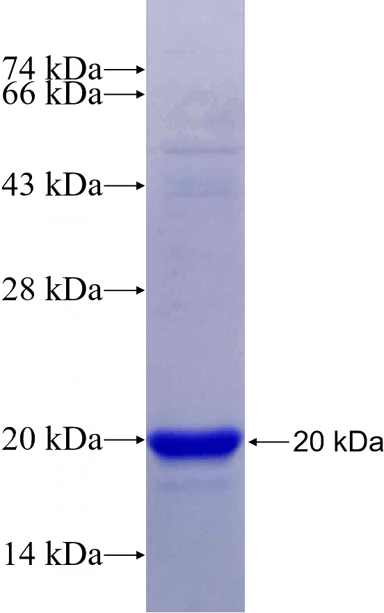Recombinant Human VASH2 SDS-PAGE