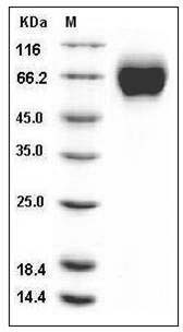 Mouse IL18R1 / CD218a Protein (His Tag) SDS-PAGE