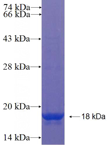 Recombinant Human ZSWIM7 SDS-PAGE
