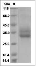 Rhesus CD137 / 4-1BB Protein (His Tag)