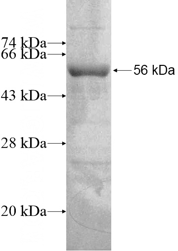 Recombinant Human ZNF3 SDS-PAGE