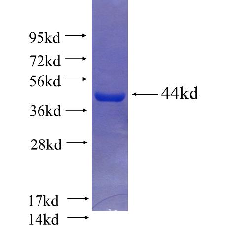 Recombinant human DDHD1 SDS-PAGE